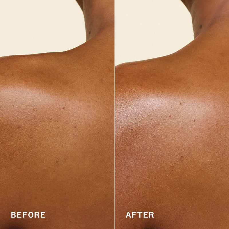 a split image shows deep-toned skin labeled “before” on the left and “after” on the right. the after image appears smoother and more luminous.