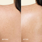 a split image shows a close-up of freckled skin labeled “before” on the left and “after” on the right. the after image appears more even and radiant in tone